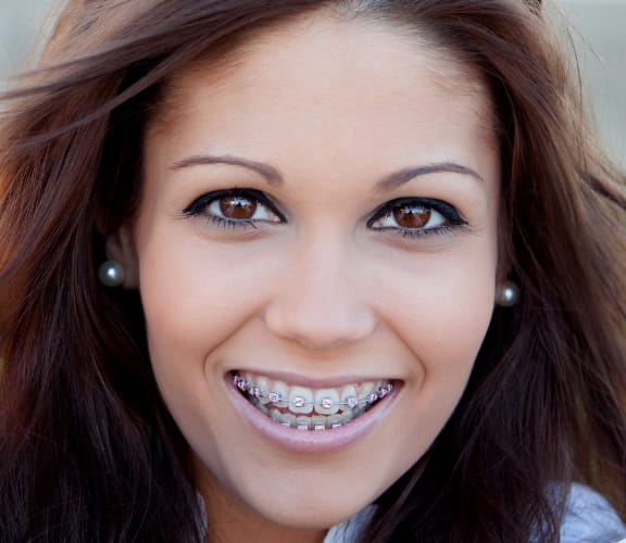 Young woman with braces holding the camera out and taking a selfie
