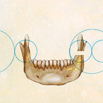 Drawing of a jawbone