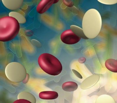 Platelet Rich Plasma